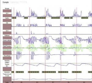 polygraphie-ventilatoire